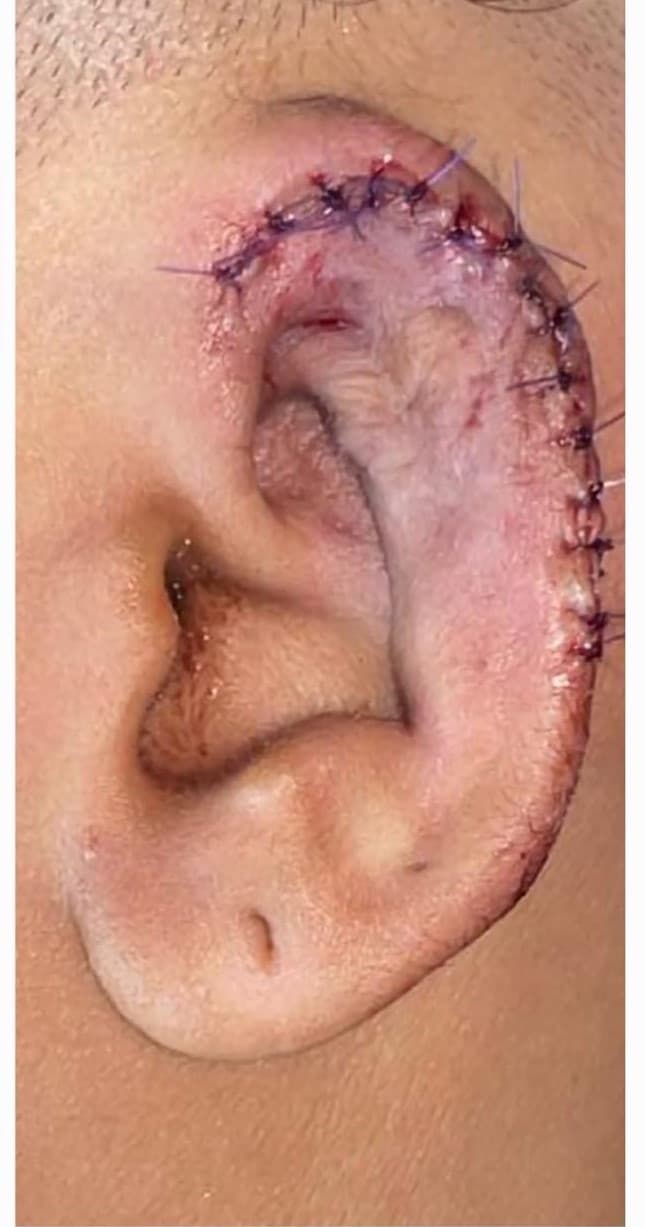 After Reconstruction