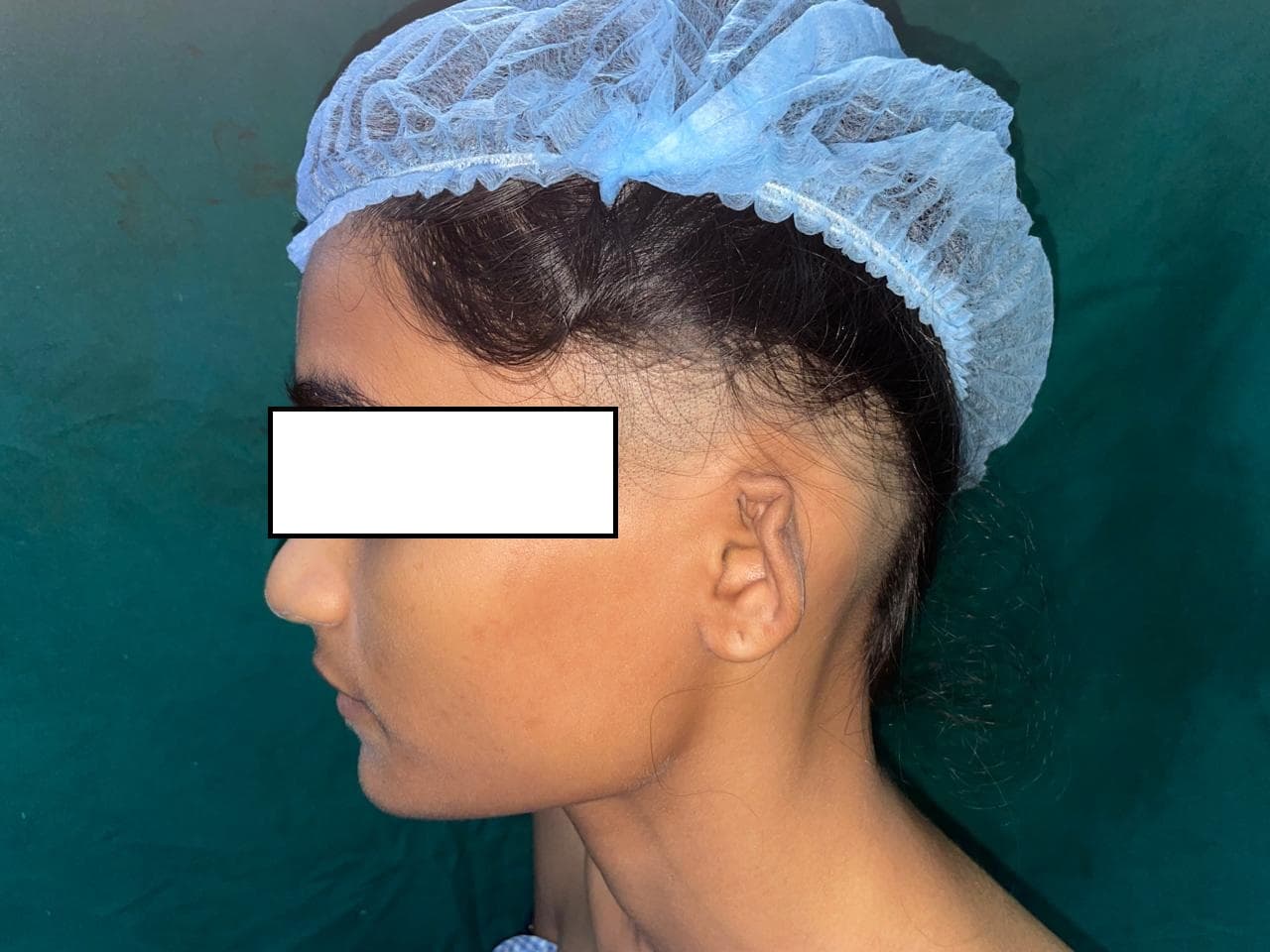 Before Reconstruction