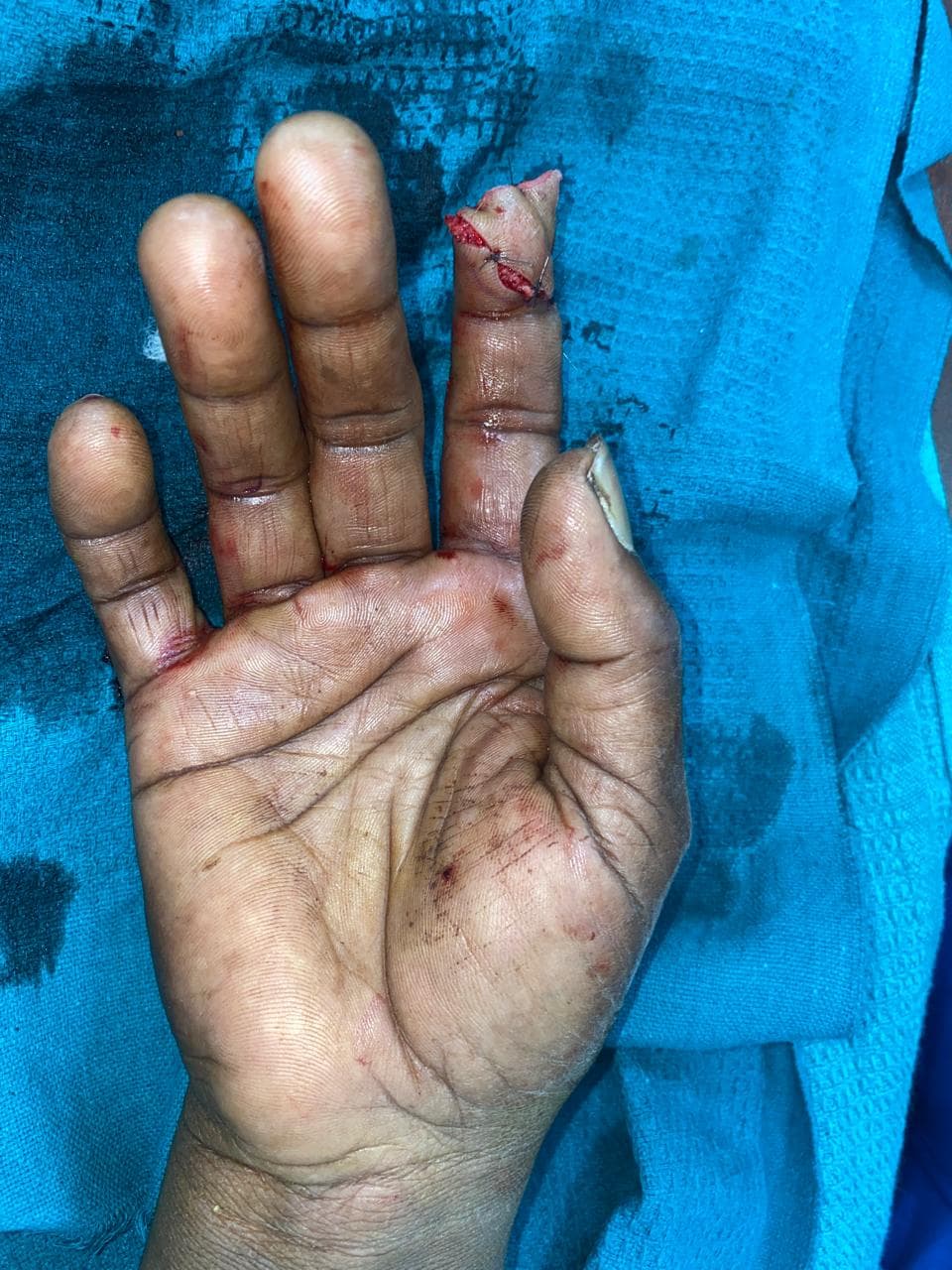 After Reconstruction