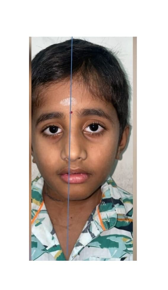 After Reconstruction