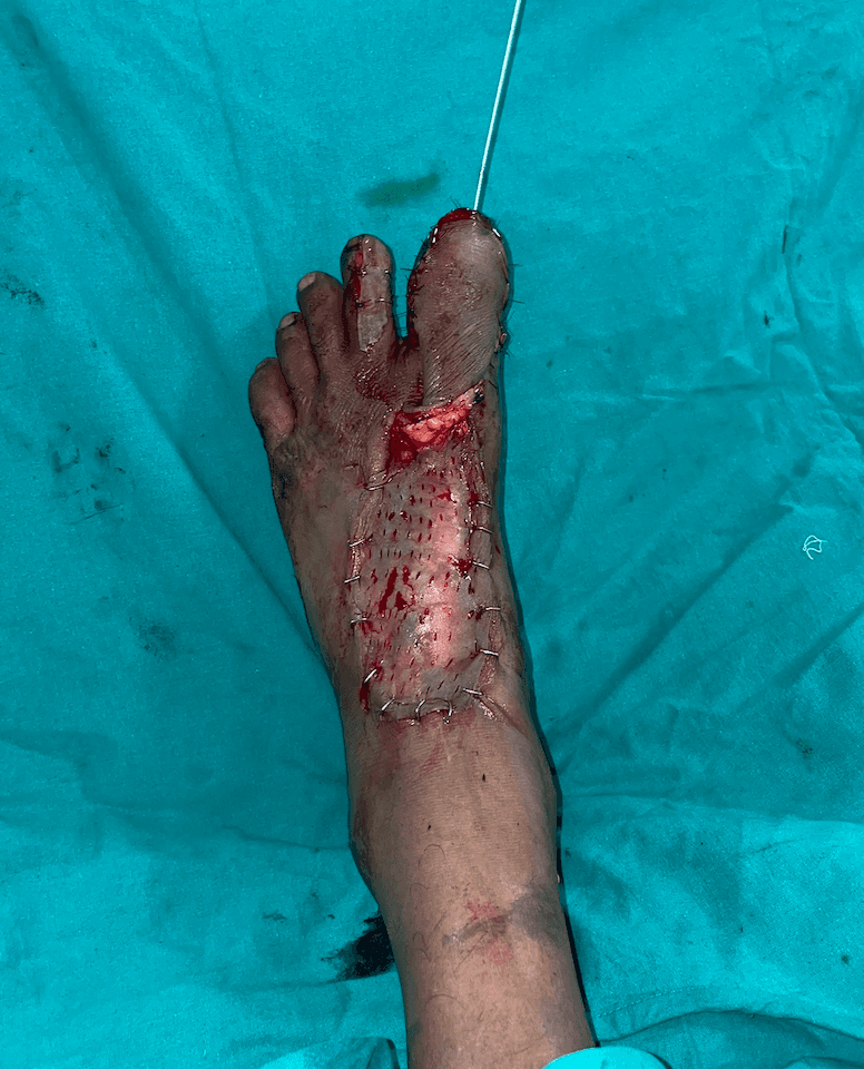 After Reconstruction