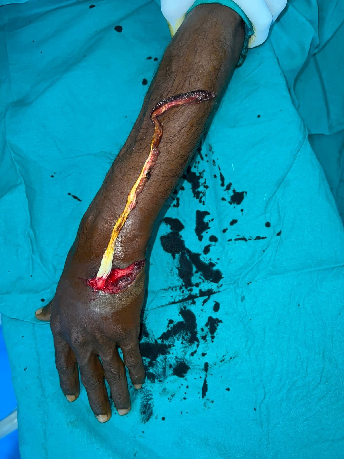 After Reconstruction