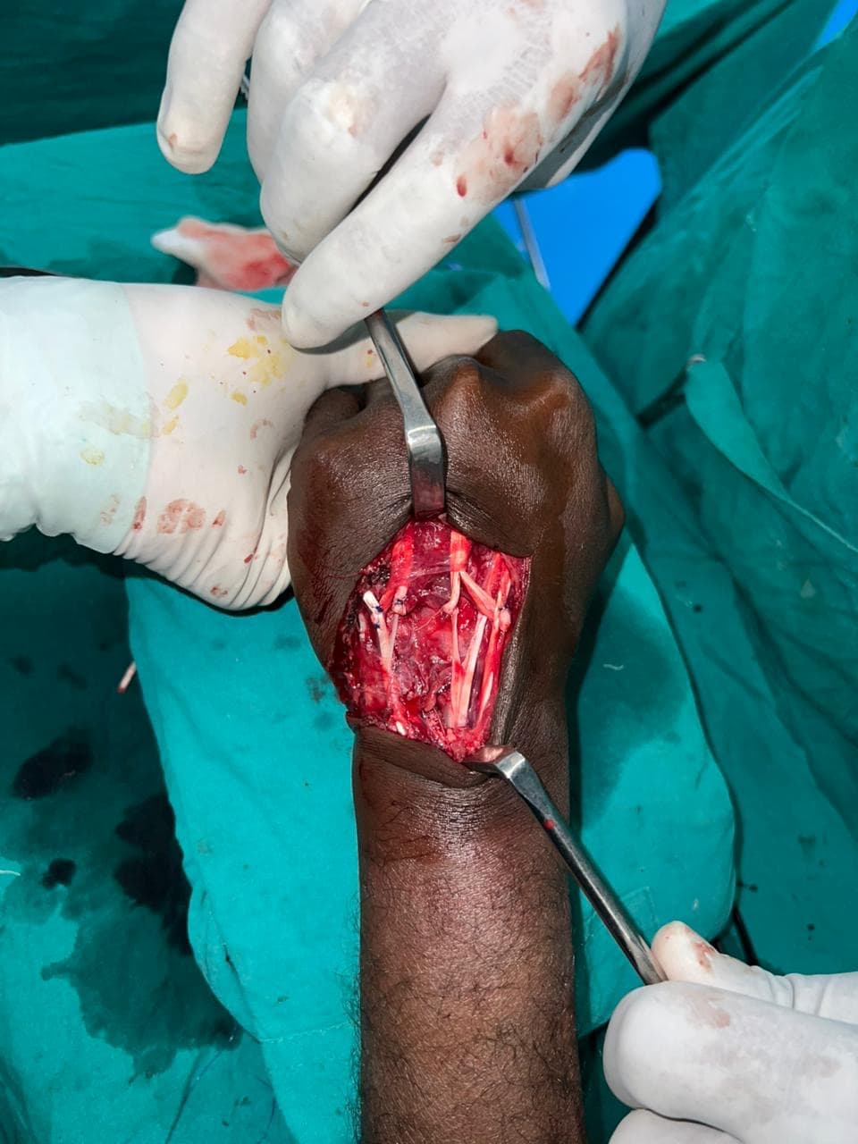 Before Reconstruction