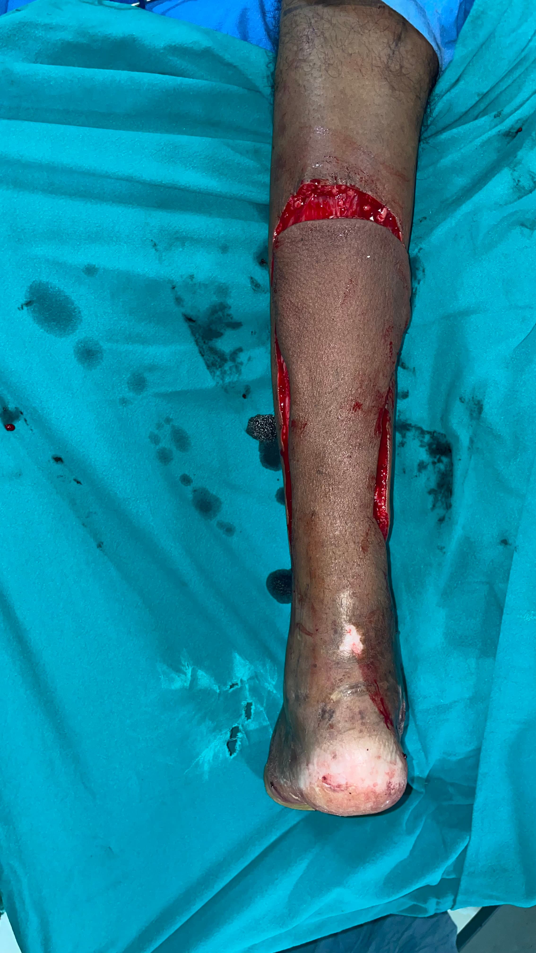 After Reconstruction