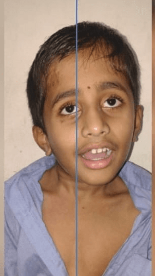 Before Reconstruction