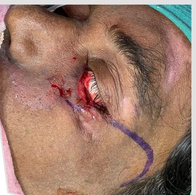 After Reconstruction