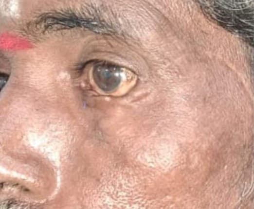 After Reconstruction