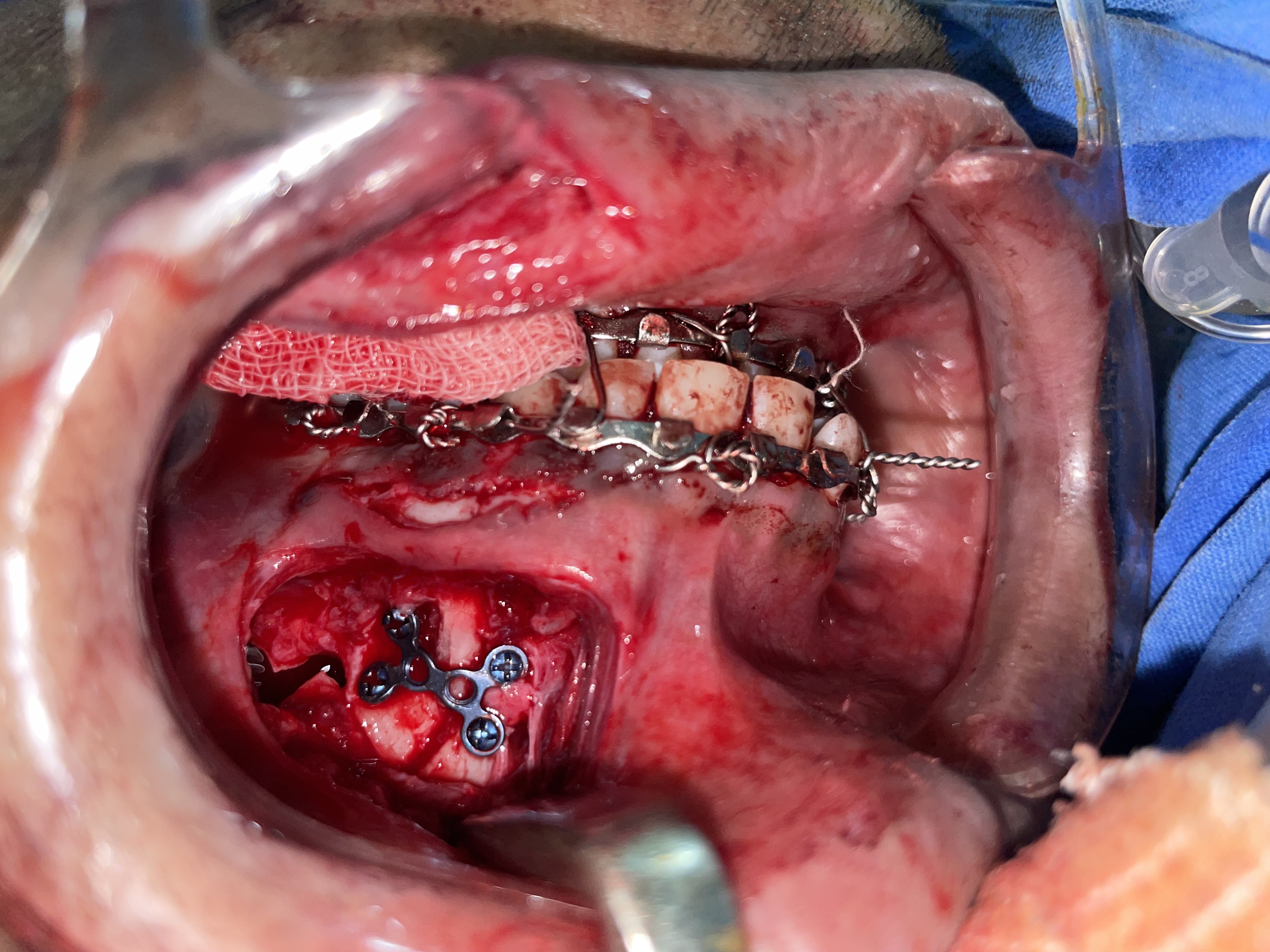 After Reconstruction