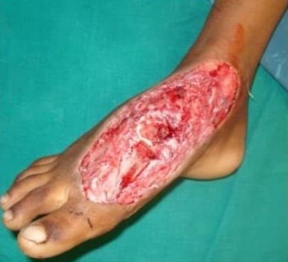 Before Reconstruction