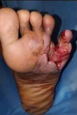 Before Reconstruction