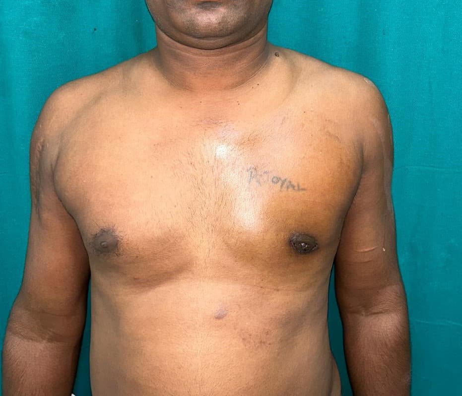 After Reconstruction