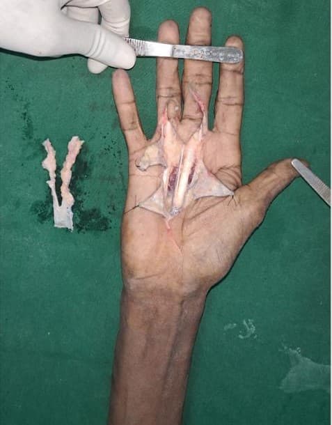 After Reconstruction