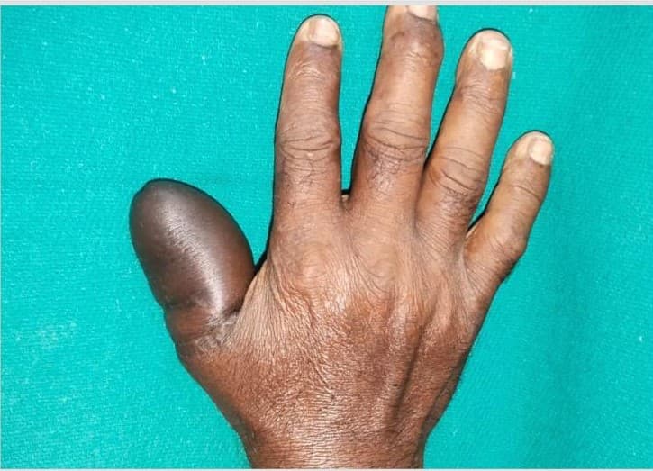 After Reconstruction