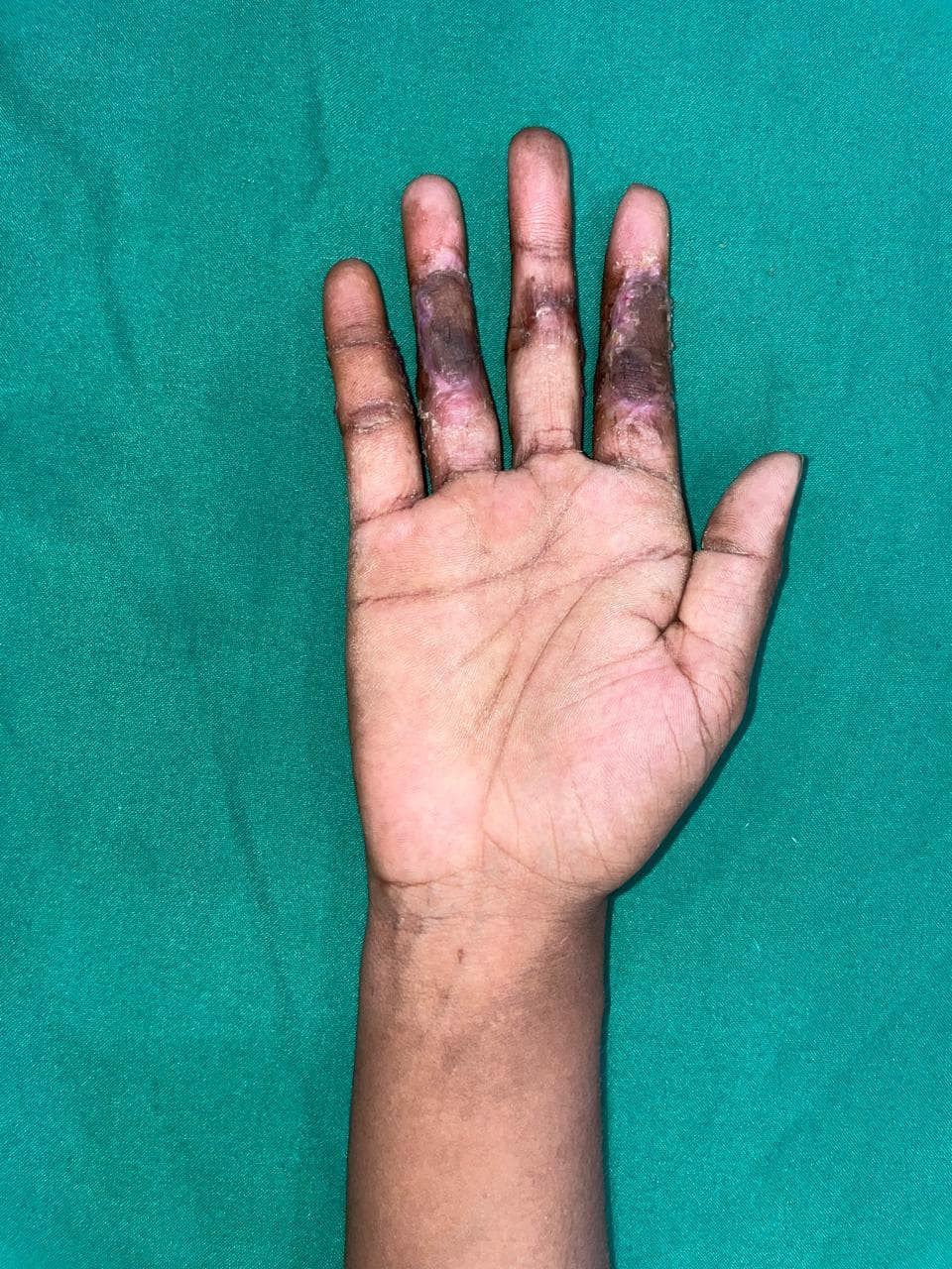 After Reconstruction