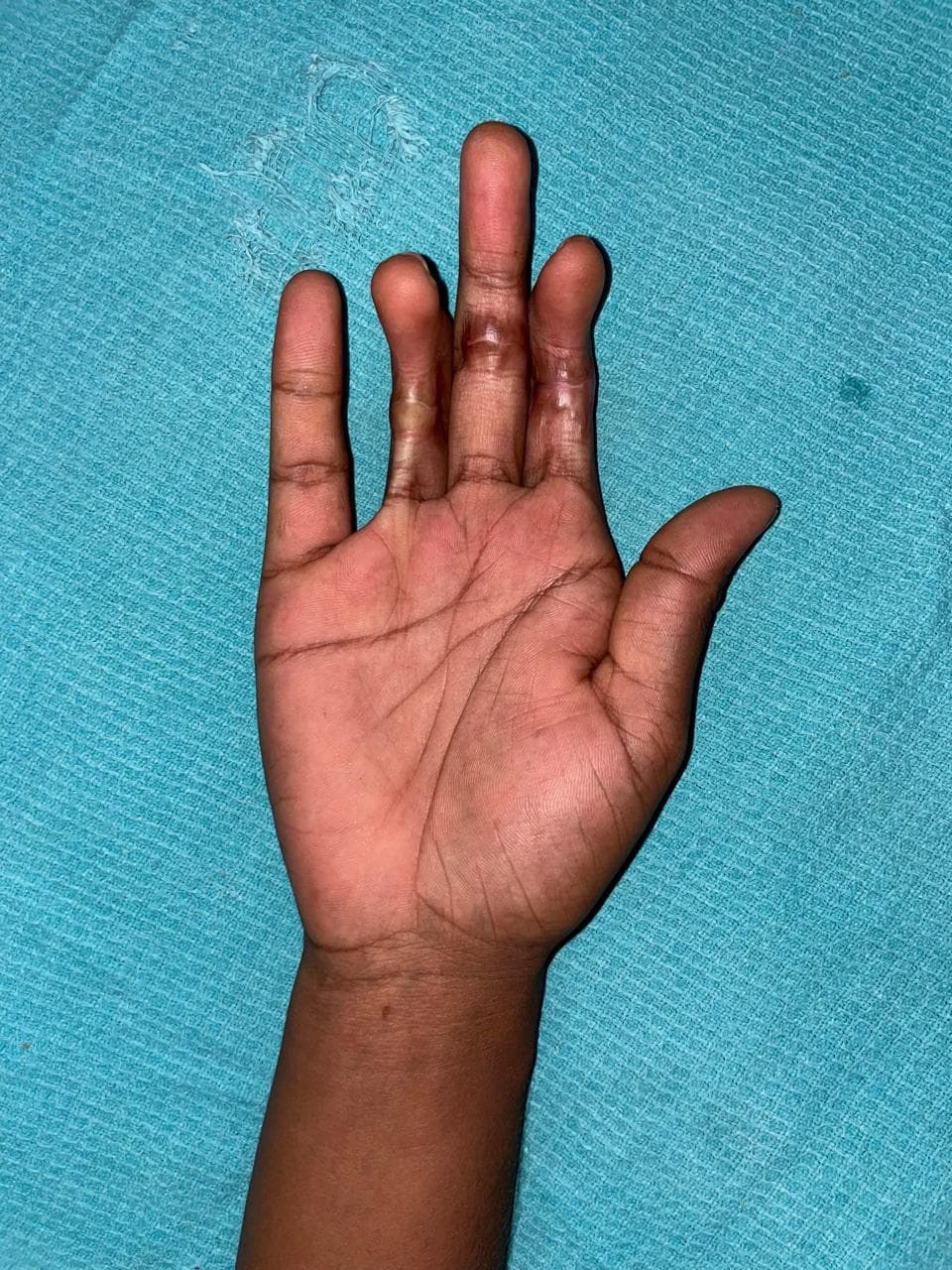 Before Reconstruction