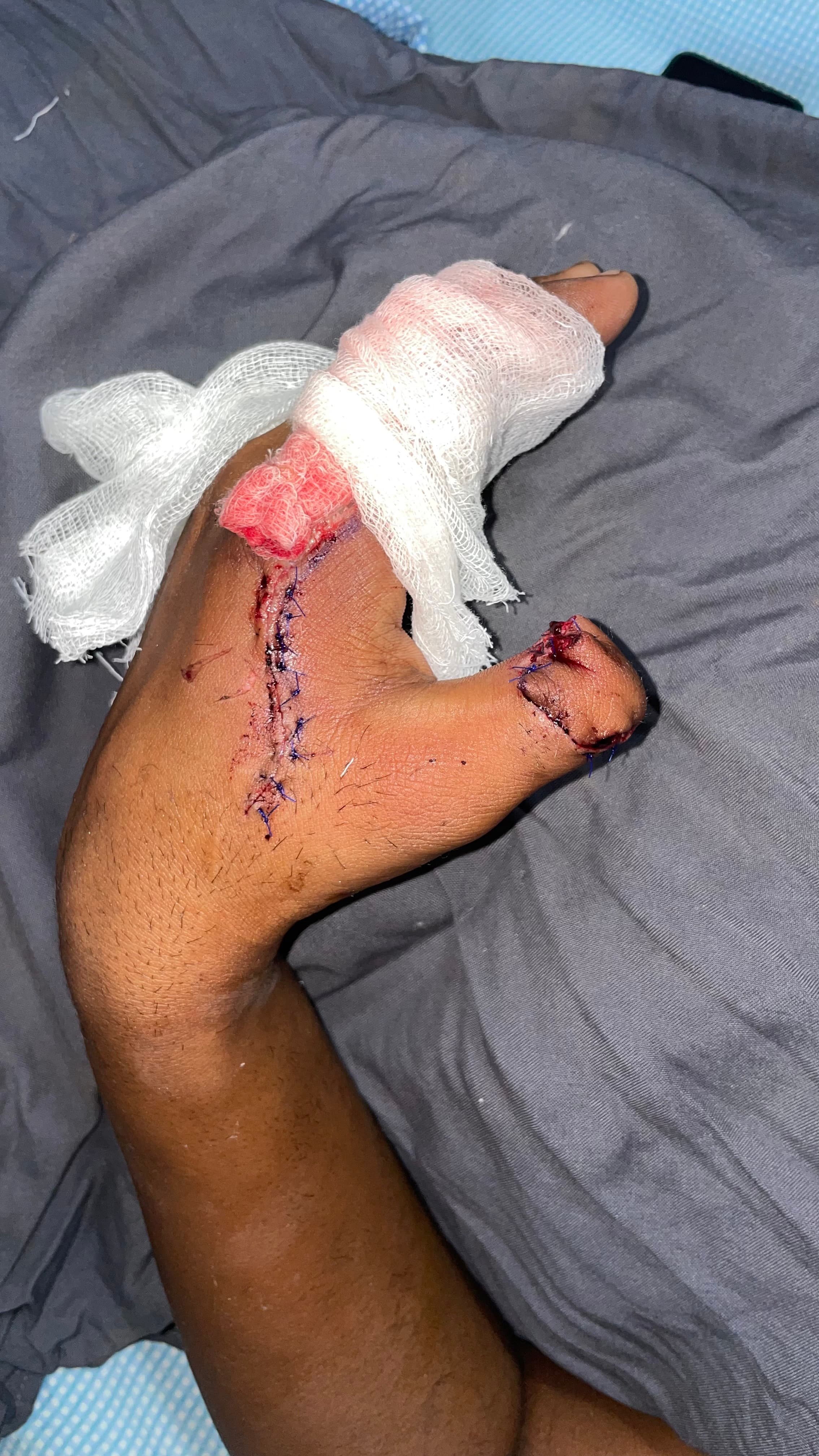 After Reconstruction