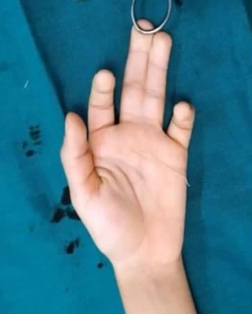 Before Reconstruction