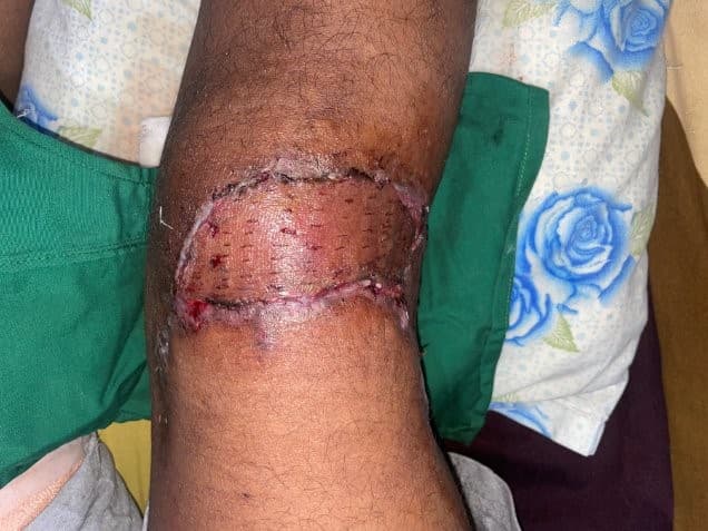 After Reconstruction