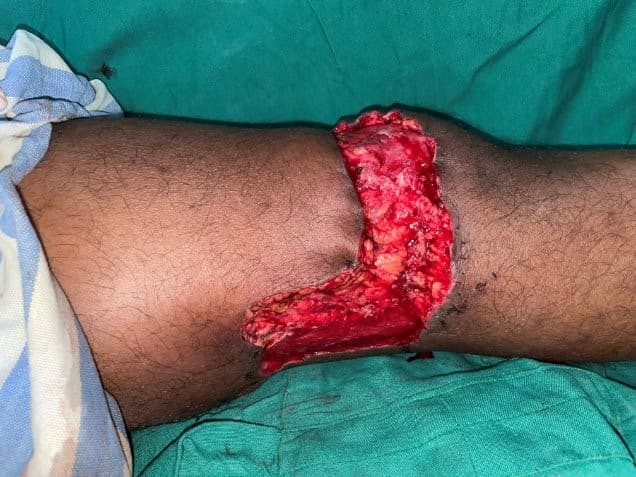 Before Reconstruction