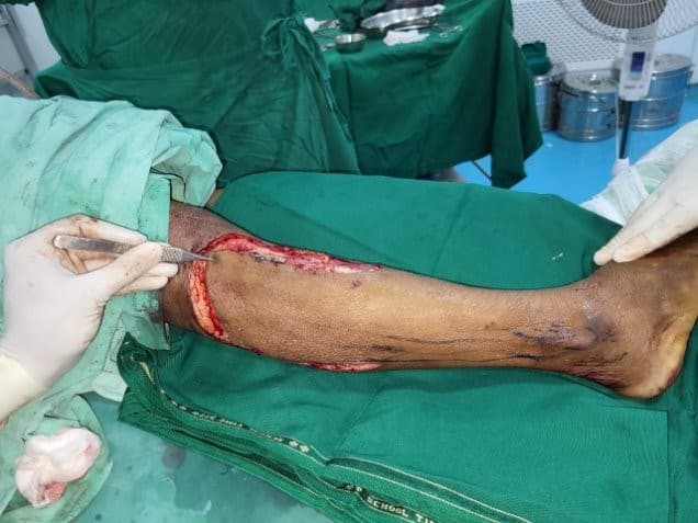 After Reconstruction