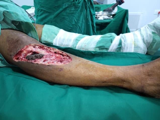 Before Reconstruction