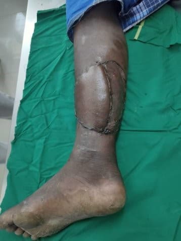 After Reconstruction