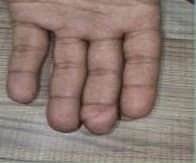 After Reconstruction