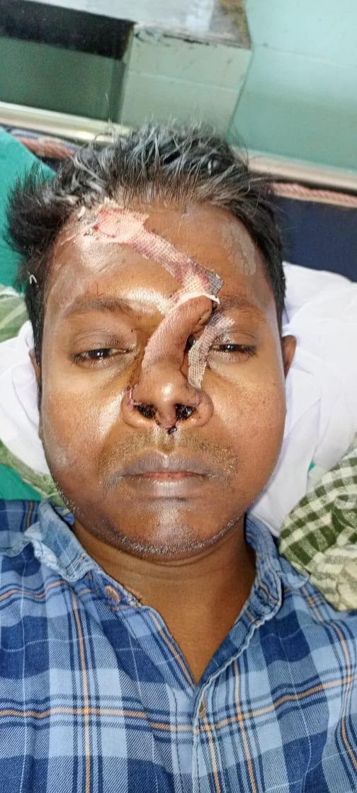 After Reconstruction