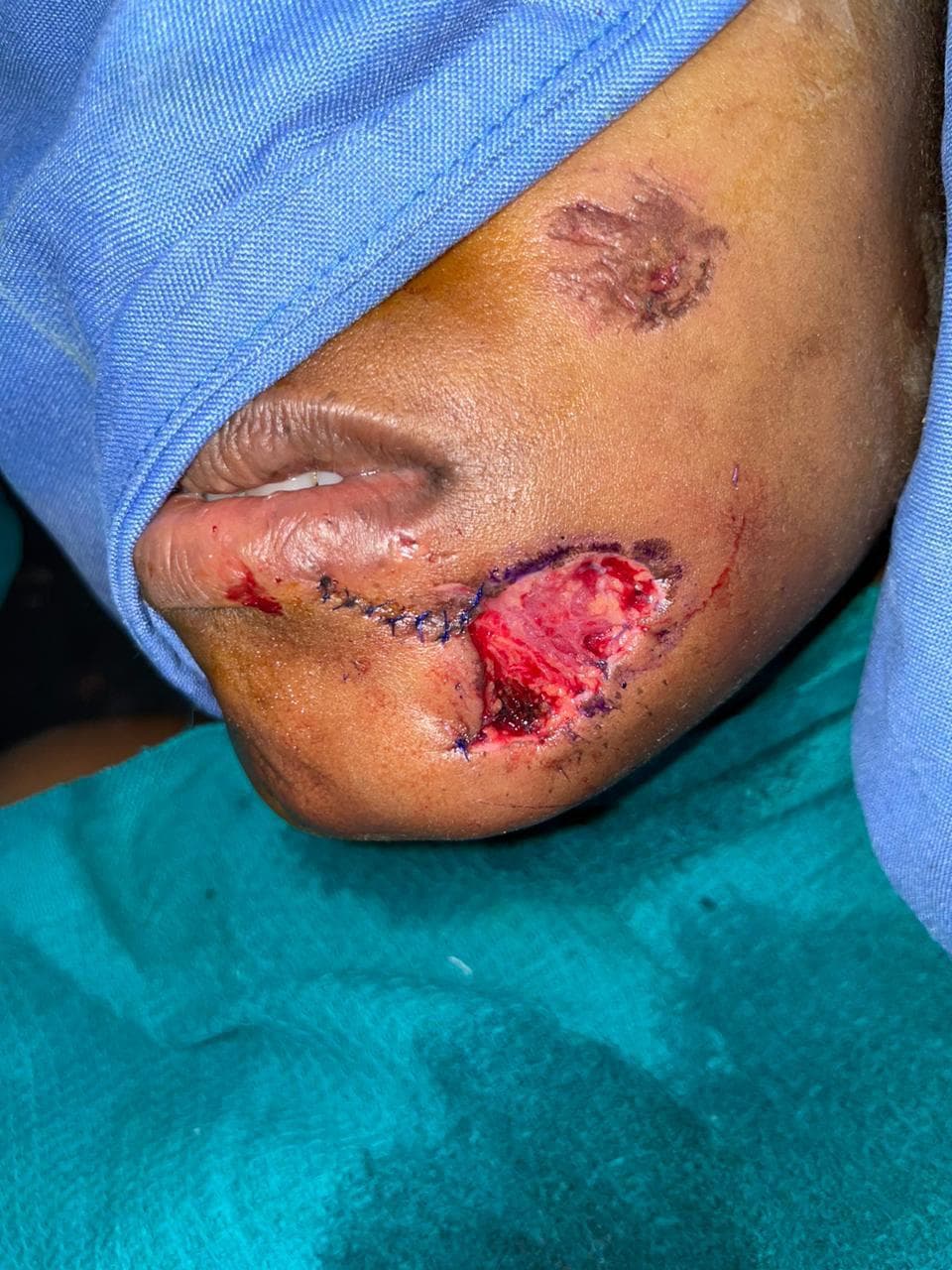 Before Reconstruction