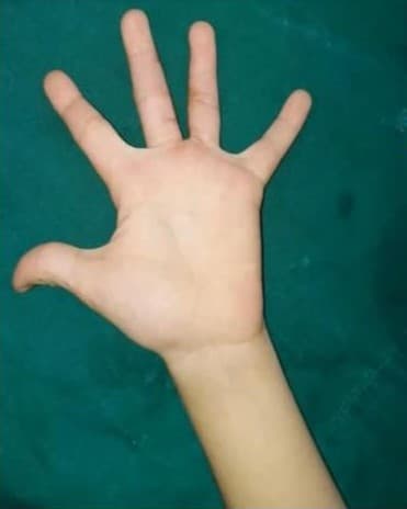 After Reconstruction